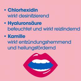 Ein aktuelles Angebot für KAMISTAD Mundspülung 150 ml Lösung Entzündung im Mund & Rachen - jetzt kaufen, Marke Stada Consumer Health Deutschland Gmbh.