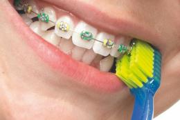Ein aktuelles Angebot für CURAPROX CS 5460 Ortho Zahnbürste 1 St Zahnbürste Zahnpflegeprodukte - jetzt kaufen, Marke Curaden Germany GmbH.