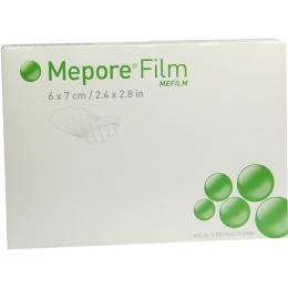 Ein aktuelles Angebot für MEPORE Film 6x7 cm 10 St ohne Verbandsmaterial - jetzt kaufen, Marke Mölnlycke Health Care GmbH.